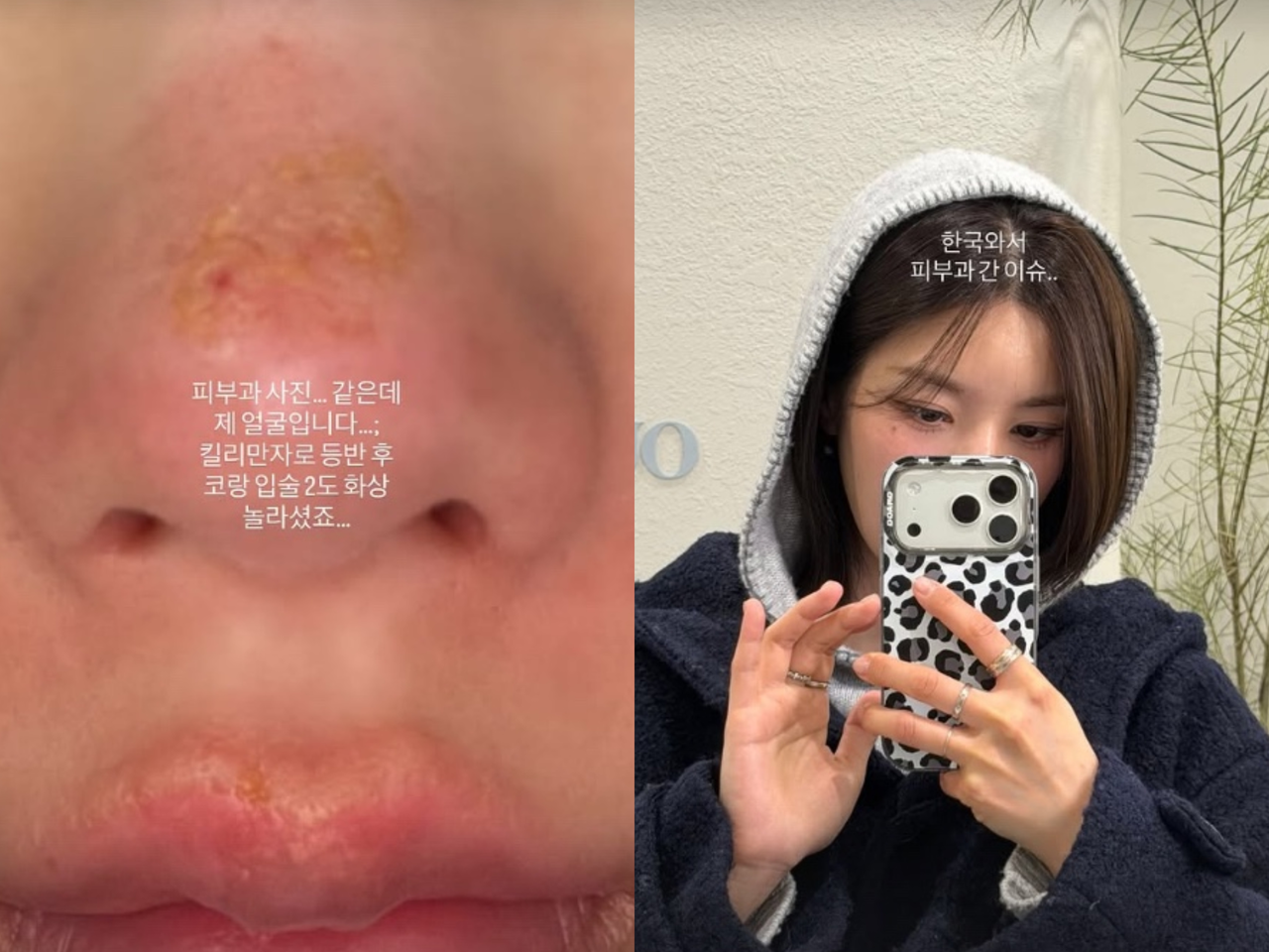 [권은비 SNS]