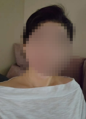 얼굴 공개한 주사 이모 관련 보도 이미지