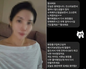 주사이모 얼굴 공개 관련 보도 이미지