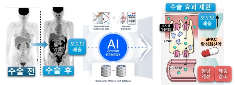 [서울성모병원 제공]