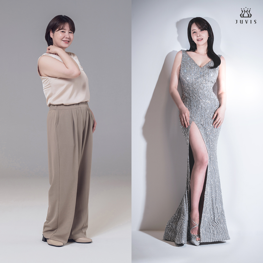 사진=쥬비스다이어트 제공