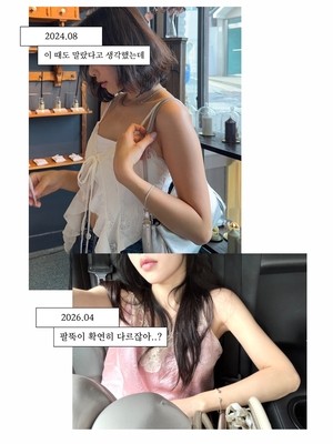 ‘박성광♥’ 이솔이, ‘뼈말라’ 시절 넘어선 역대급 반토막 팔뚝 라인