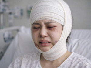 피 흘리고, 퉁퉁 붓고…숨 못 쉬던 딸, 한창나이에 ‘사지마비’ 됐다 [메디컬 생존 게임]