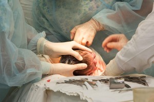 Behind Korea's soaring C-section rates: Risk-averse mothers, doctors in a strained system