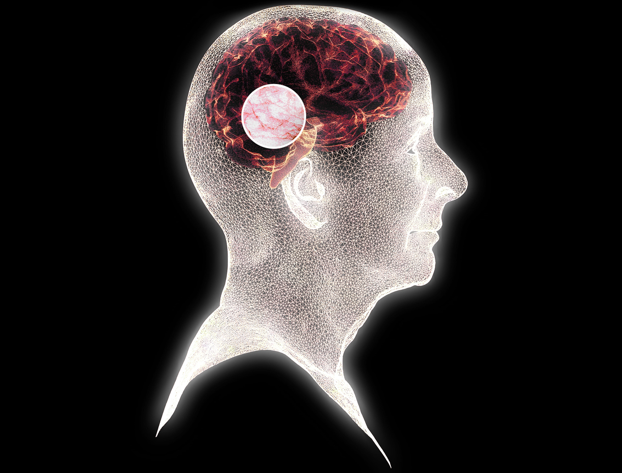A graphic depicting the brain activity of a person with a degenerative disease. (123rf)