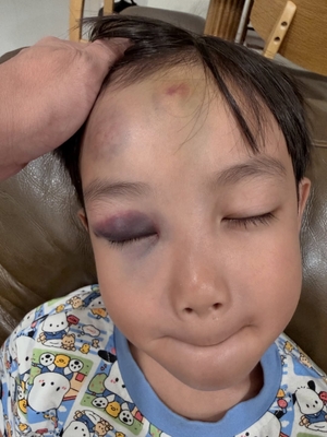6-year-old Singaporean boy struck by airport buggy at Incheon Airport