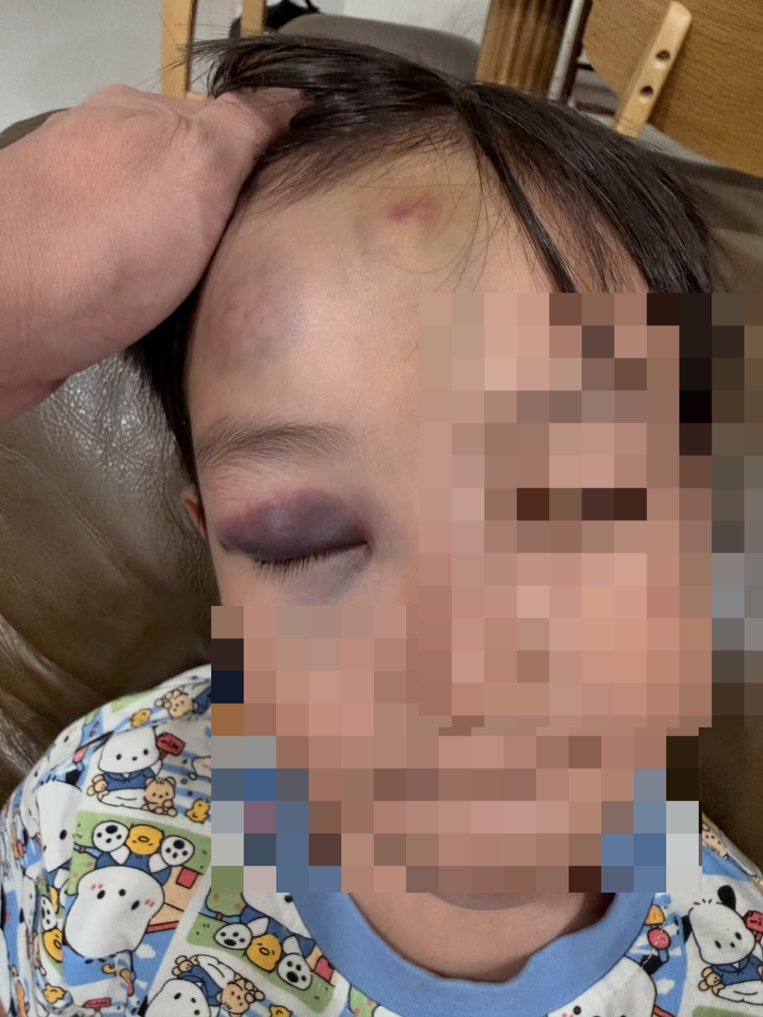 A 6-year-old Singaporean boy was injured after being struck by an airport buggy at Incheon Airport on Wednesday. (Kayden Khoo's Instagram)