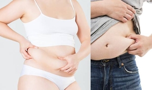 "마운자로, 뱃살은 안 빠지네요"...원하는 부위만 '쏙' 골라 빼는 치... - 뉴스 썸네일 이미지