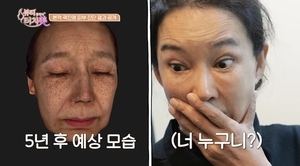 ‘종말이’ 곽진영, 57세 갱년기에 급격한 노화…결국 피부 클리닉