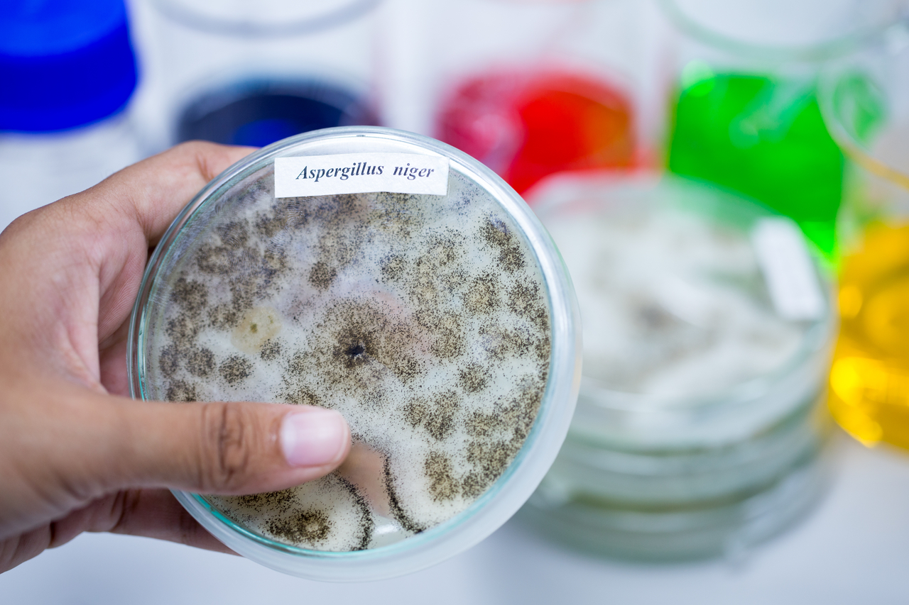 검은곰팡이(아스페르길루스 니게르, Aspergillus niger). [게티이미지뱅크]