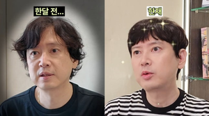 ‘원조 꽃미남’이었는데…김진 맞아? 53세 급노화 얼굴에 ‘충격’