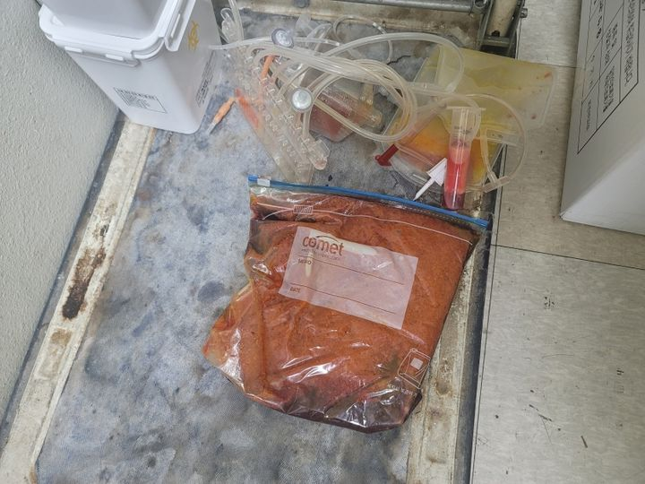 지퍼팩에 담긴 폐지방. 조직물류폐기물을 일반의료폐기물에 섞어 보관하다가 적발됐다. [서울시 제공]