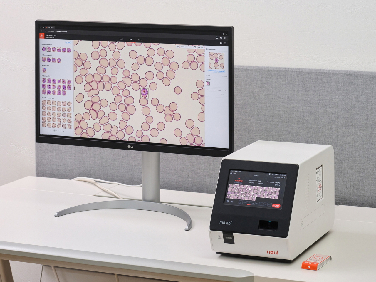 Noul's AI-based malaria diagnostic solution, miLab MAL. [Noul]