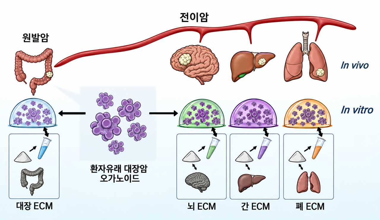 대장·뇌·간·폐에서 세포를 제거하고 남은 세포외기질(ECM)로 젤 형태의 배양재료를 만든 뒤, 환자 유래 대장암 세포를 넣어 종양 덩어리로 자라는 과정을 분석하는 실험 모식도.