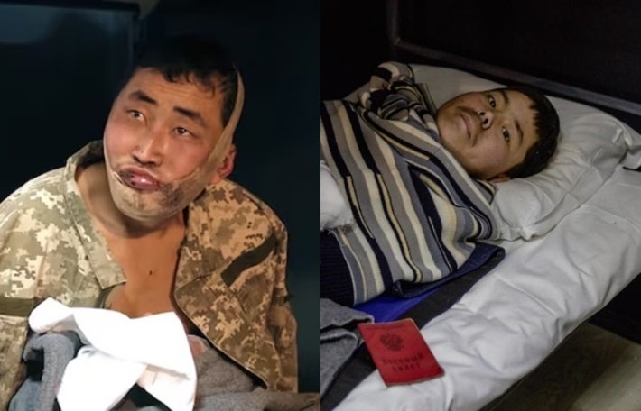 Two North Korean soldiers captured by Ukrainian forces are seen in this image shared by Ukrainian President Volodymyr Zelenskyy on X. (Zelenskyy’s X account)