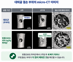 한약재 ‘방풍’추출물 뼈 재생에 효과, 자생한방병원 연구결과