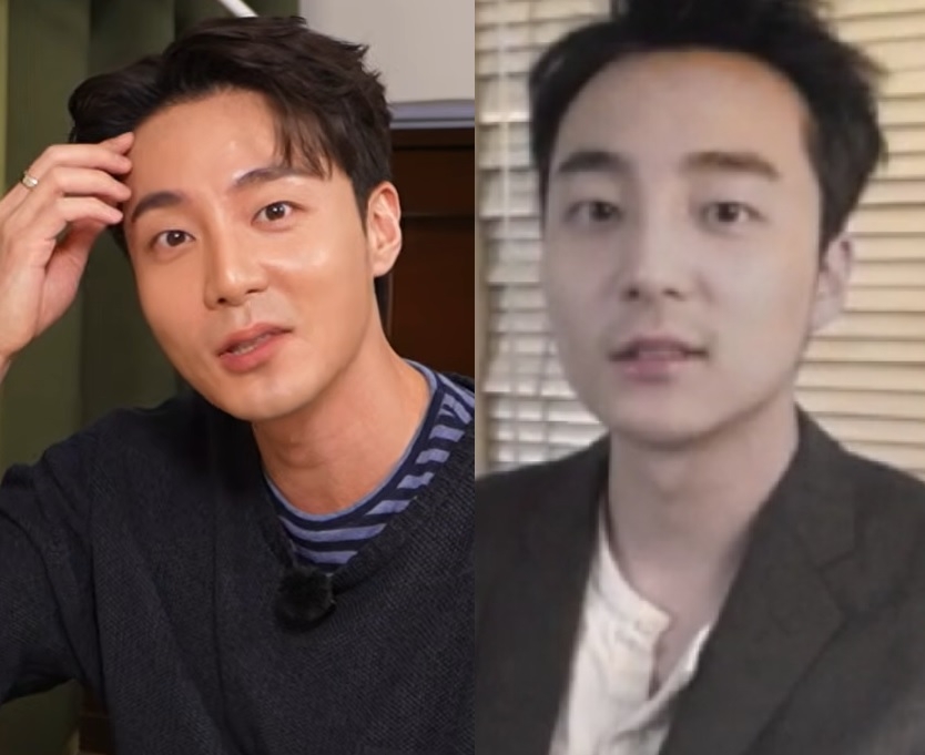 로이킴 33살인데 탈모 증상 있었나…모발이식 고백 “꽤 됐다. 너무 티 나나?”