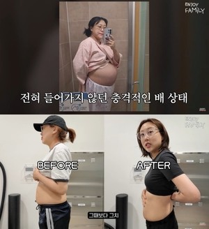 ‘쌍둥이맘’ 임라라, 충격적인 배 상태..“이미 늘어난 살가죽”(‘엔조이커플’)