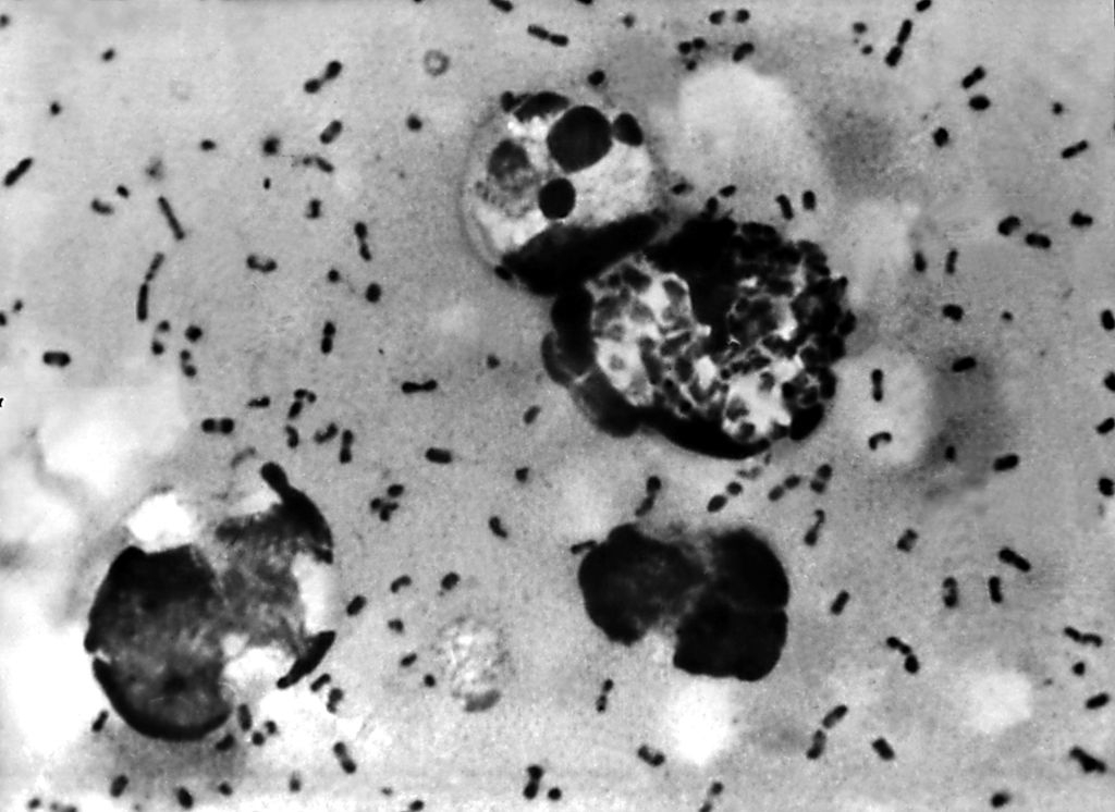 Yersinia pestis bacteria, which causes plague [US Centers for Disease Control and Prevention]