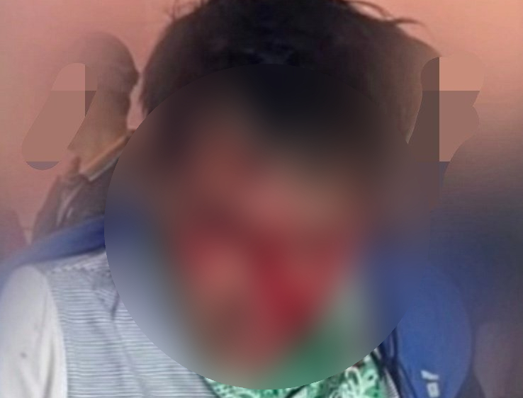 A photo of the suspect in the Incheon stabbing circulating online shows his blood-covered face without any blurring. [Online community]