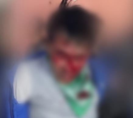 Suspect A, 59, who went on a knife rampage at a shopping complex in Guwol-dong, Namdong-gu, Incheon, on Tuesday. The photo, taken after he was subdued by bystanders and arrested by police, shows blood on his face from being struck by chairs and other objects. [Social media]