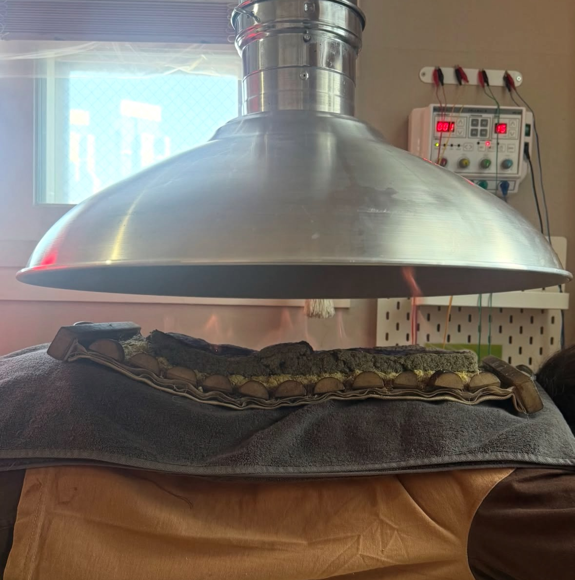 Mugwort moxibustion at Green's Acupuncture in Busan (Screenshot from Threads: @nin_220205)