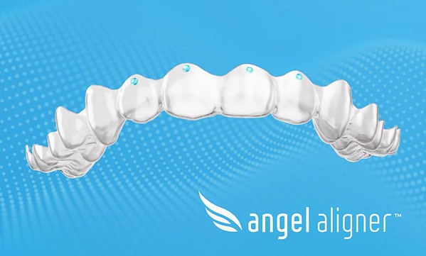 Paris Court Ruling on Discontinued Feature Will Have Minimal Impact on Angelalign Customers