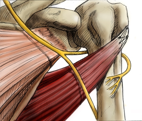 A reference image of the anterior latissimus dorsi and teres major tendon transfer procedure performed at Yeosu Baek Hospital.