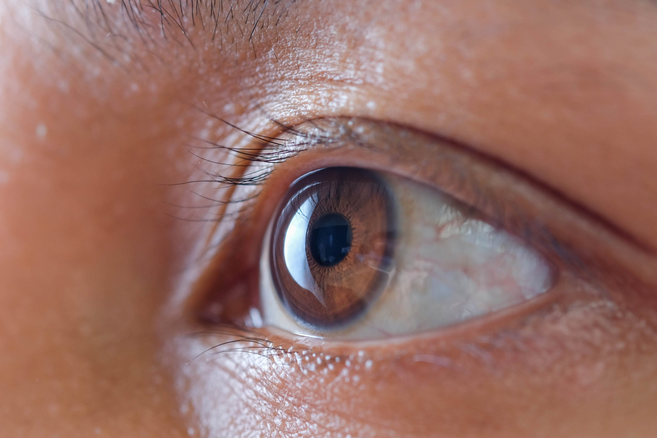 An eye. This photo is not directly related to the article. [123rf]