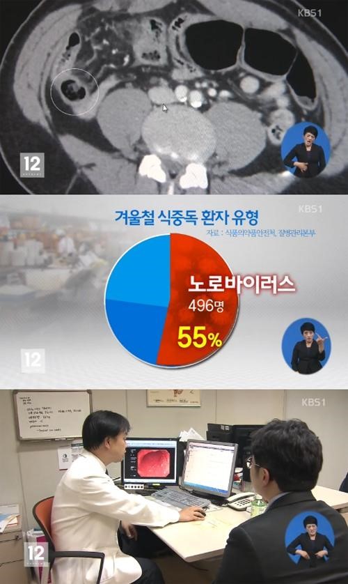 사진 : 겨울 장염 증상 / KBS1 뉴스