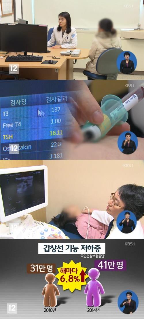 '갑상선 기능 저하증 증상' / KBS 뉴스 캡처
