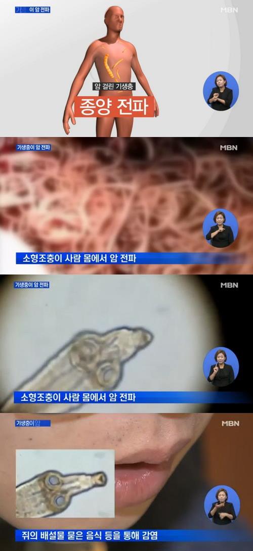 '기생충감염의 특성' / MBN뉴스 캡처