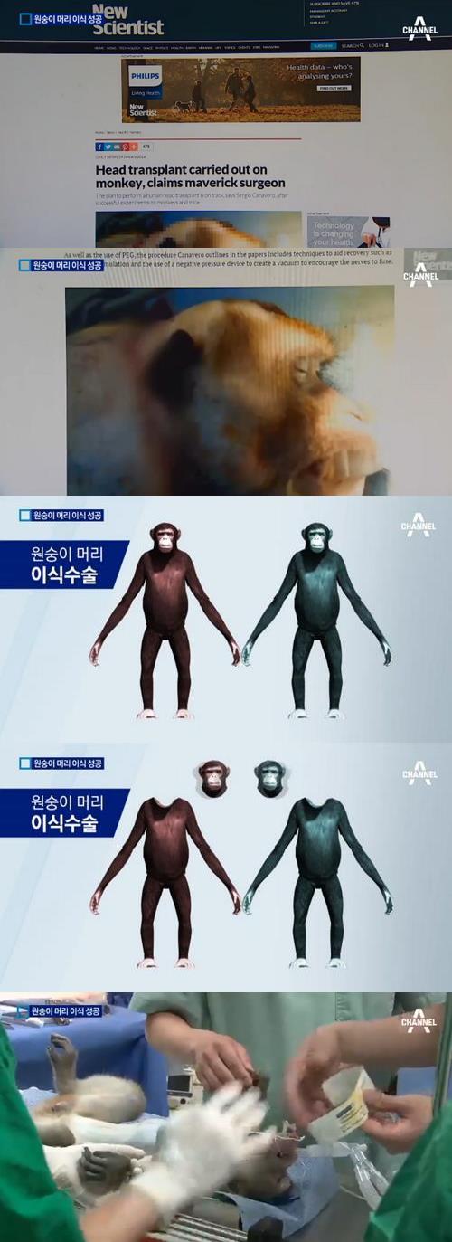 '원숭이 머리 이식 성공' / 채널A 캡처