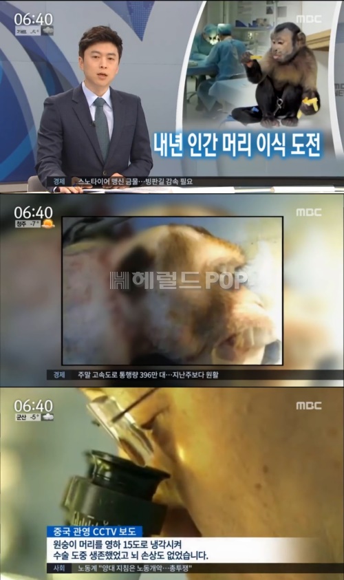 사진:MBC 방송캡쳐