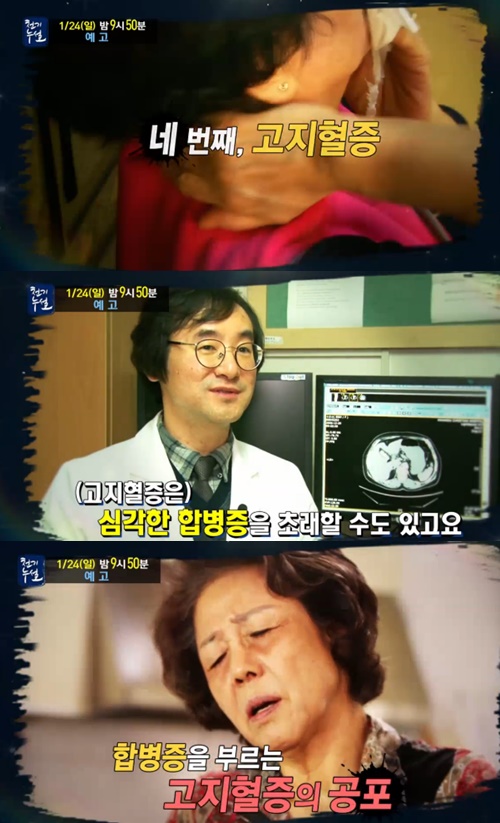 사진: 천기누설 방송 캡쳐