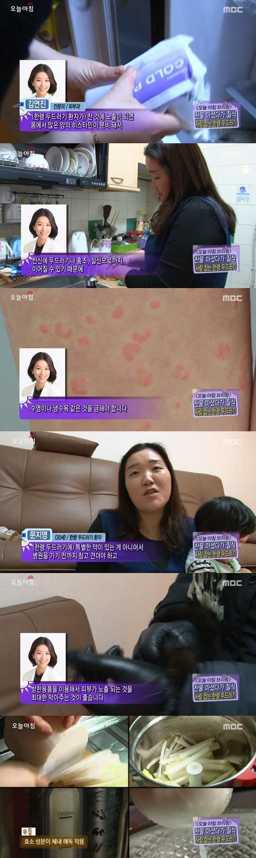 '한랭두드러기 특징' / MBC 생방송 오늘아침 캡처