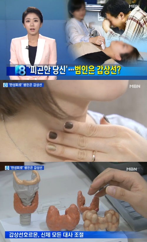 사진 : MBN