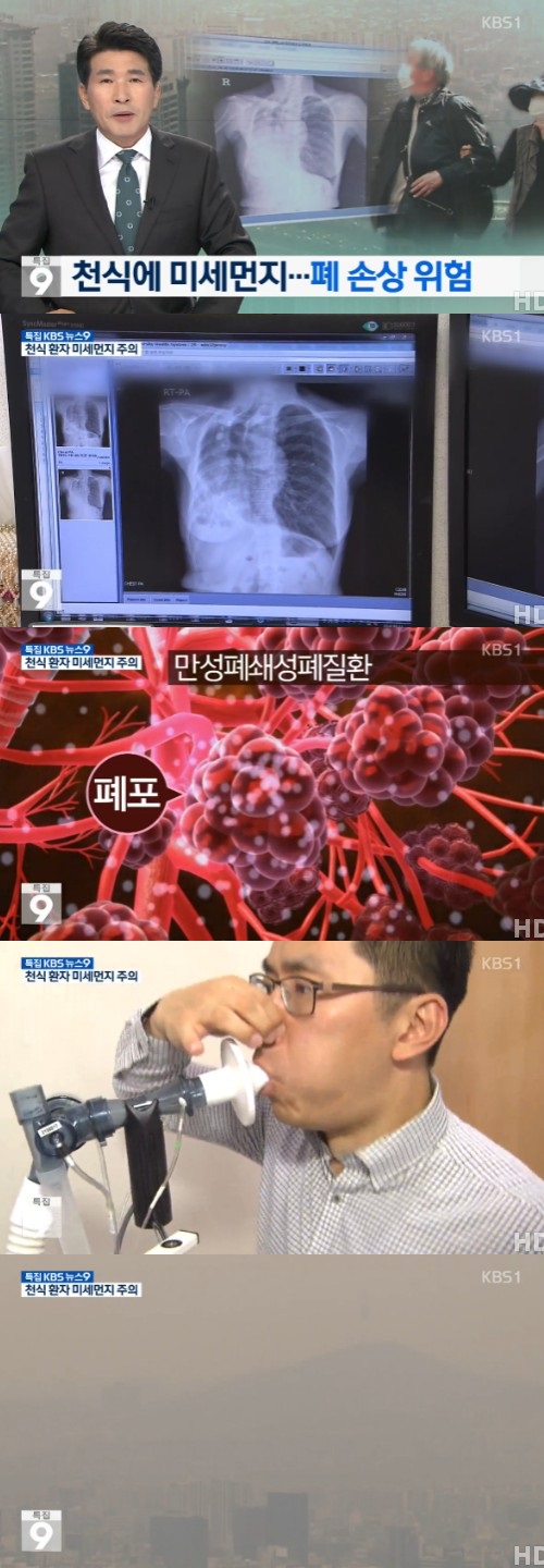 kbs 뉴스