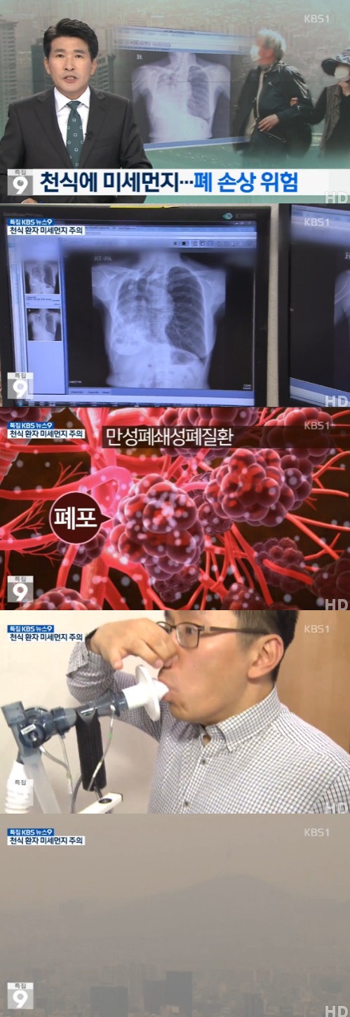 kbs 뉴스