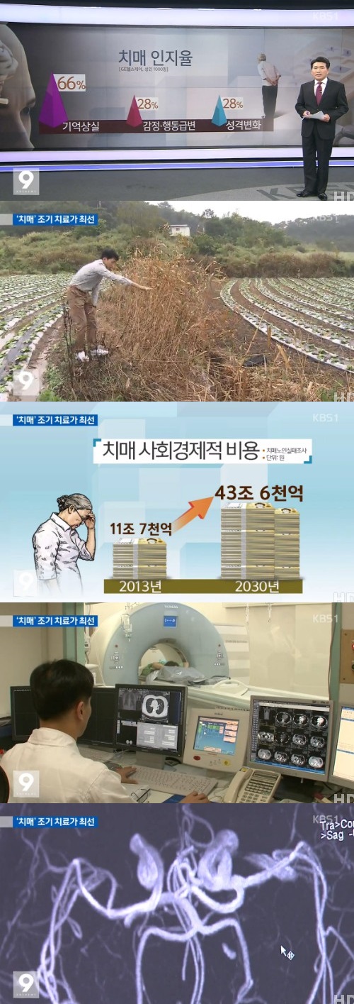 KBS 뉴스 캡쳐