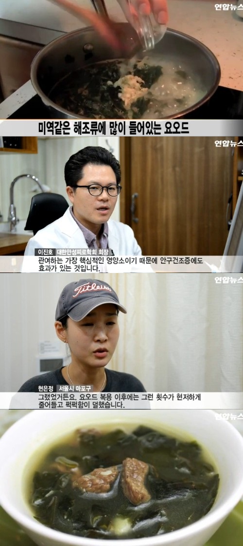 연합뉴스 TV 캡쳐