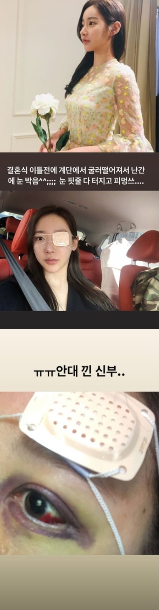 송다예 인스타