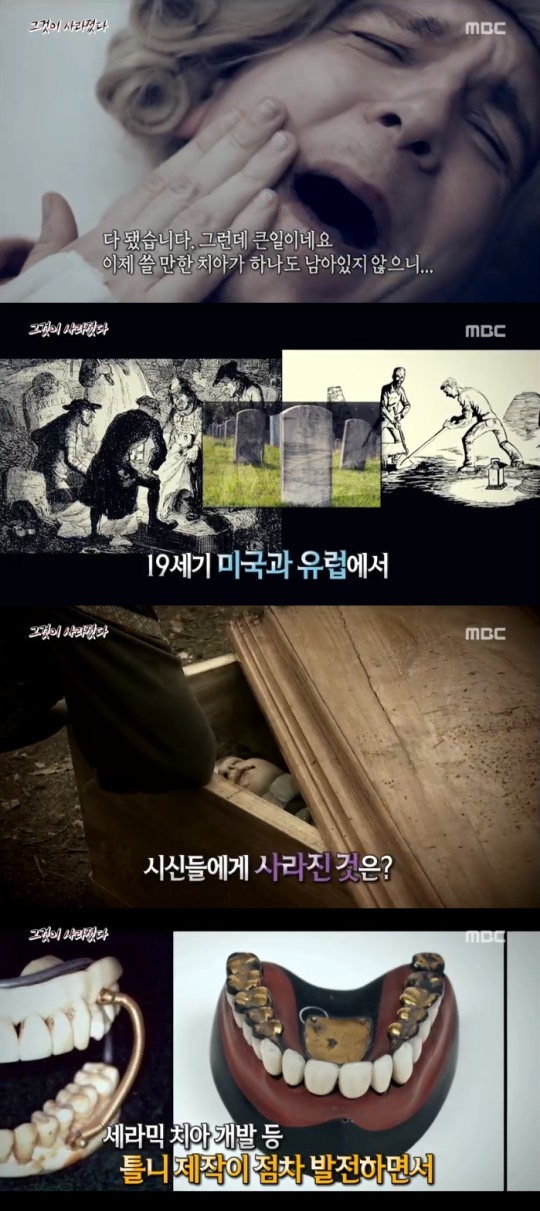 MBC '서프라이즈' 캡처