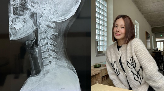 아이비 인스타그램