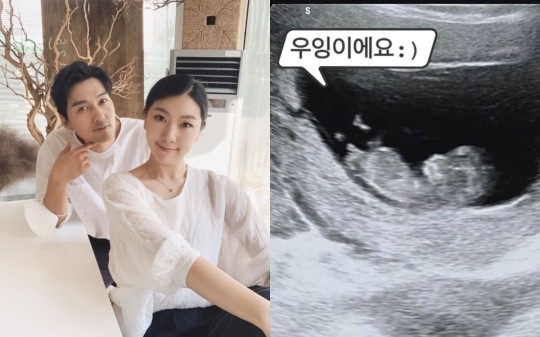 서수연 인스타그램