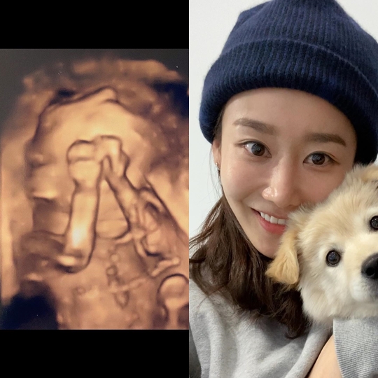 금미 인스타그램
