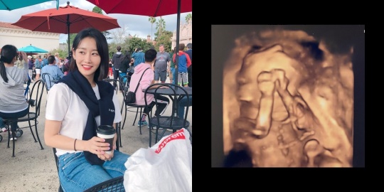 금미 인스타그램
