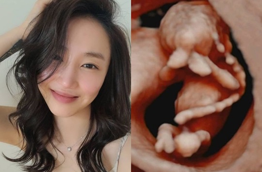 선데이 인스타