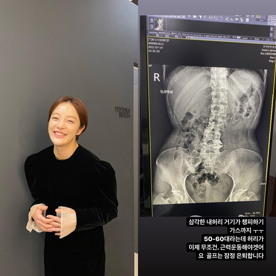황보라 인스타그램