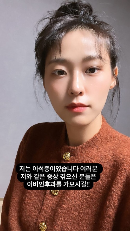 설현 인스타 스토리